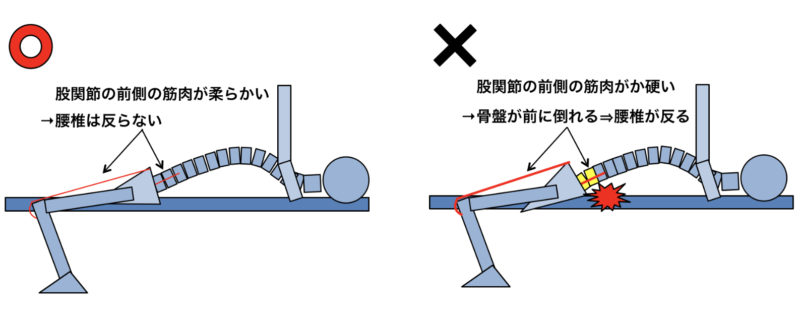 腰痛になった場合の解決策　股関節の前側のストレッチをする